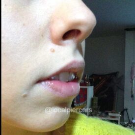 Glass Nose Retainer